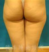 �p�g���פ�N�e